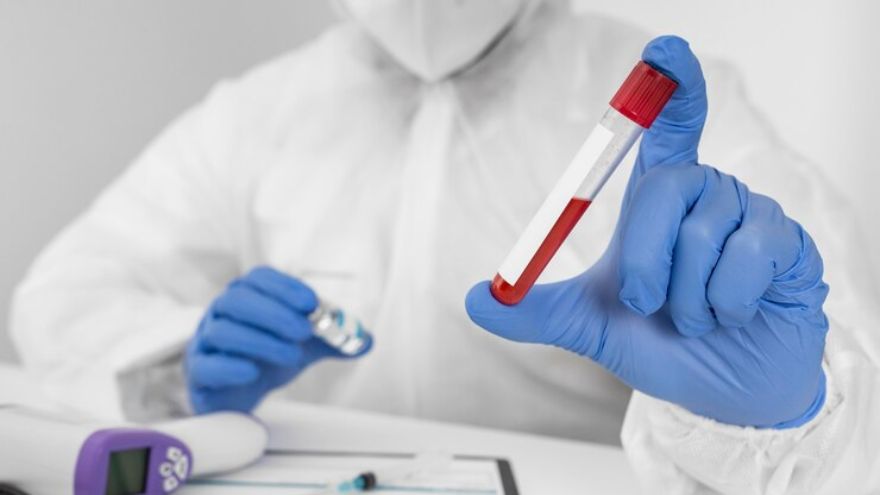 Understanding MCH Blood Test